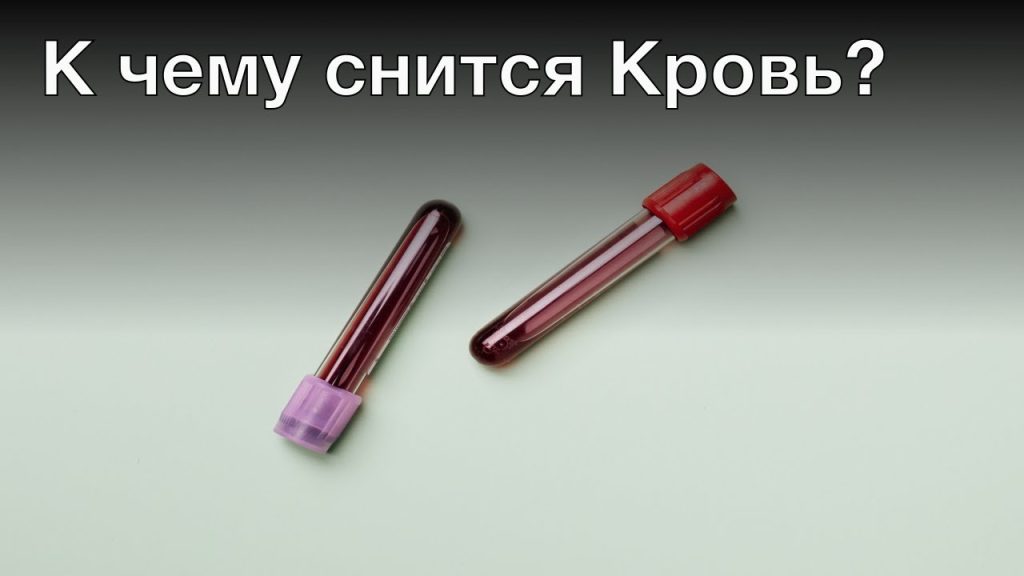 К Чему Снится Кровь: Толкование и Значение Сновидения